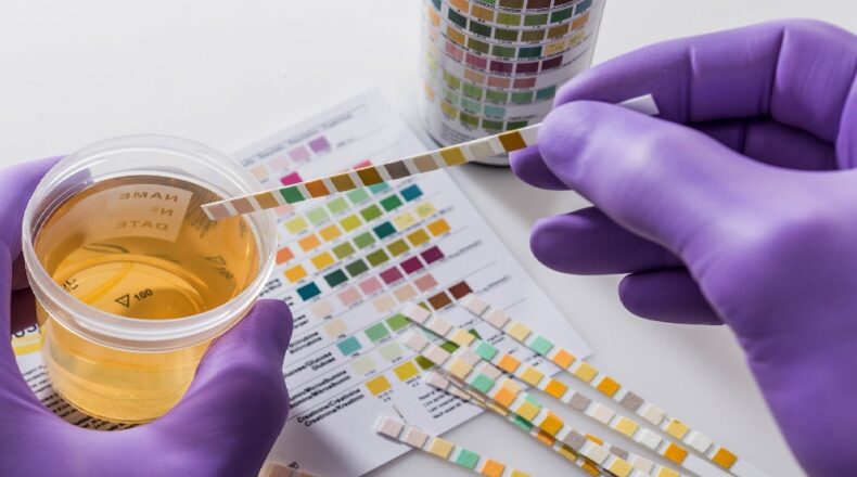 Fake urine is the trending solution which is similar to natural human pee