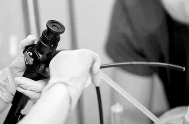 Gastroscopy Complications