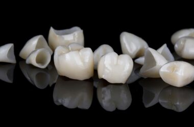 Porcelain Veneers