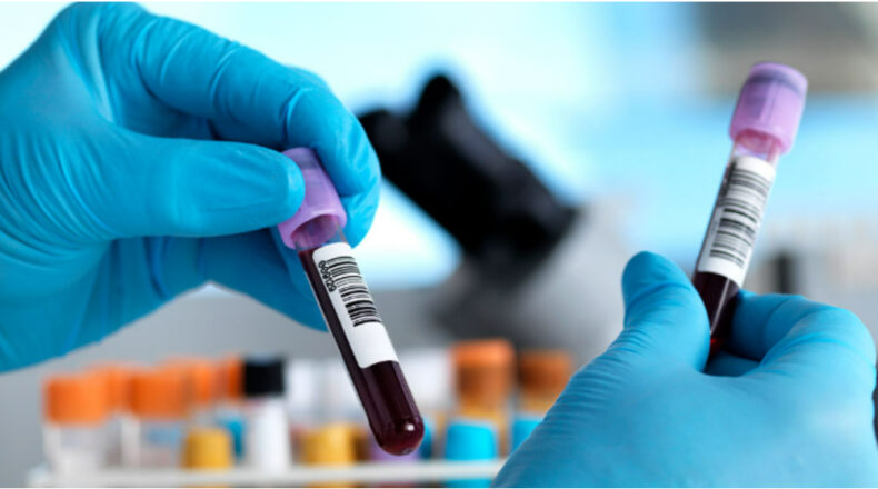 Blood Test Center