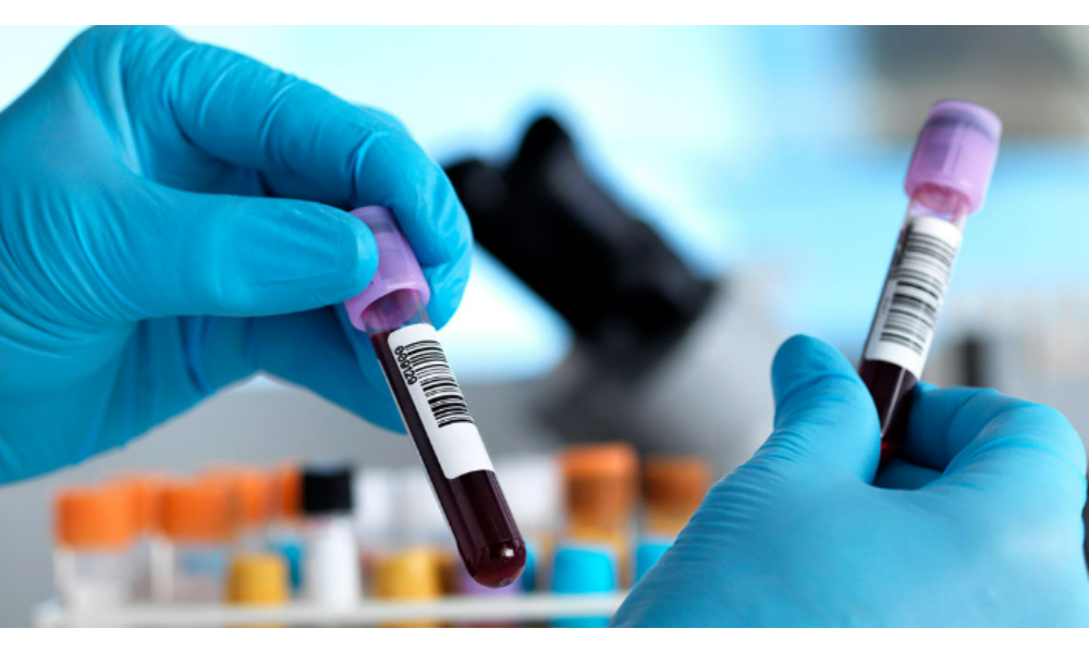 Blood Test Center