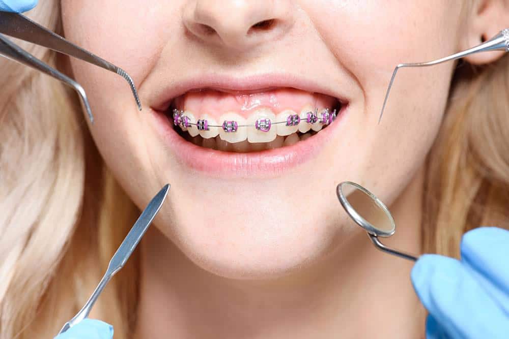 Knowing about orthodontics