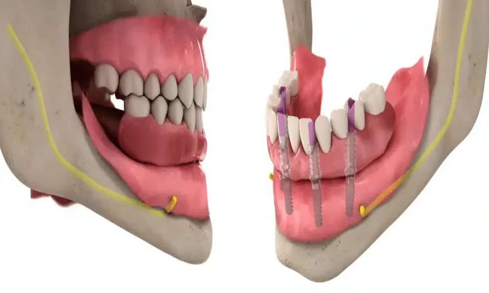 How General Dentistry Supports Long Term Gum And Bone Health